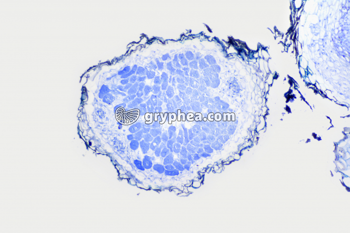 Racine de Trèfle montrant une nodosité (association symbiotique avec des bactéries) x40 - gryphea.com